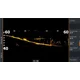 LOWRANCE - Sonda Activetarget 2